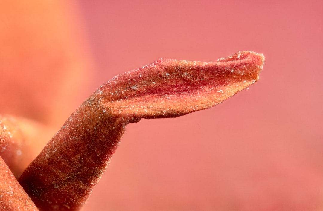 Photo genital herpes treatment