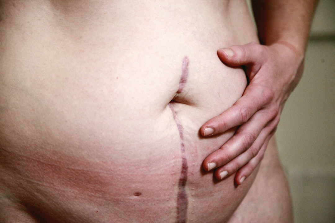 Photo bloating