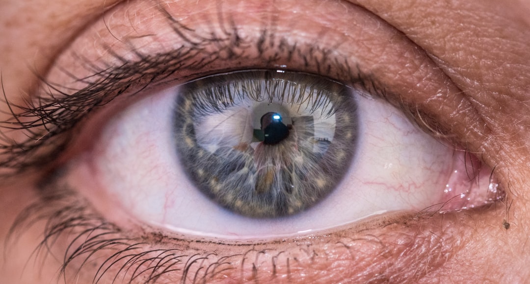 Photo green cataract symptoms