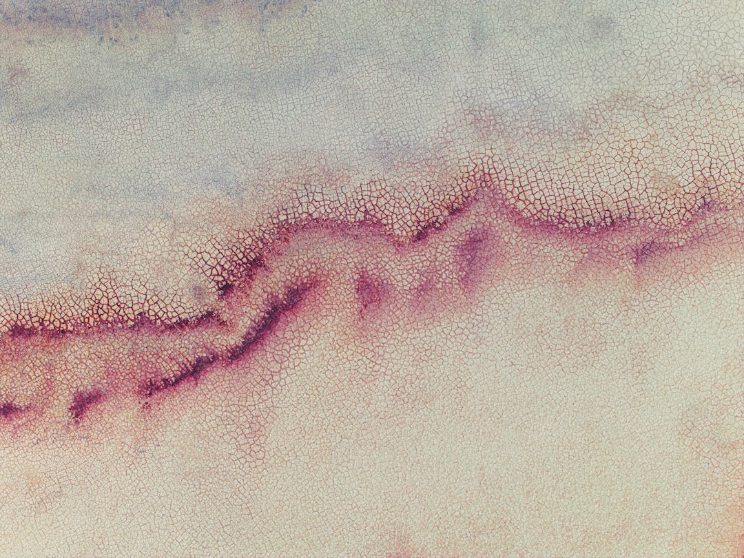 Photo bruise