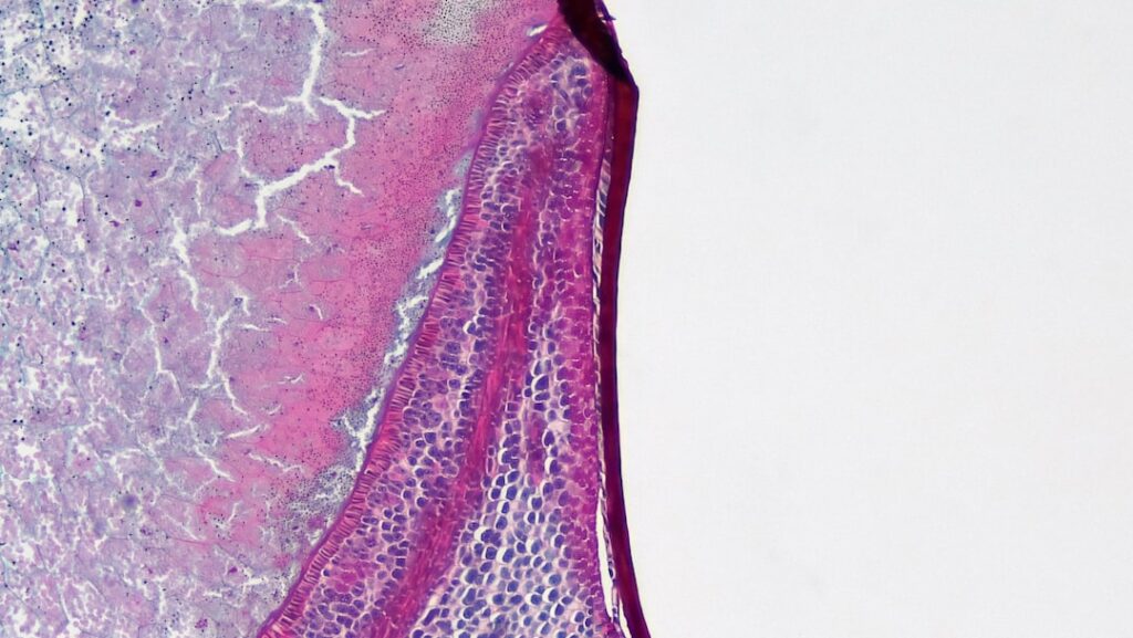 Megnagyobbodott Nyirokcsomó A Hasban: Okok és Kezelés