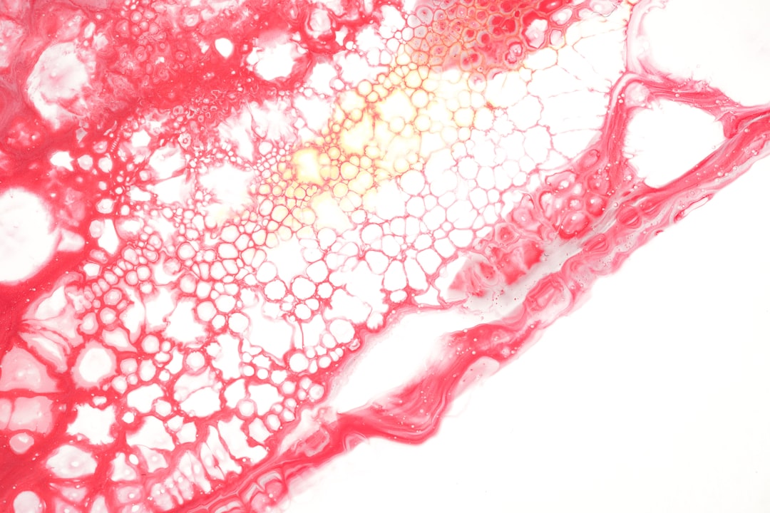 Photo bladder infection