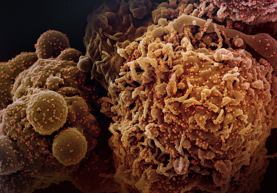 Photo Colorectal cancer genetic background