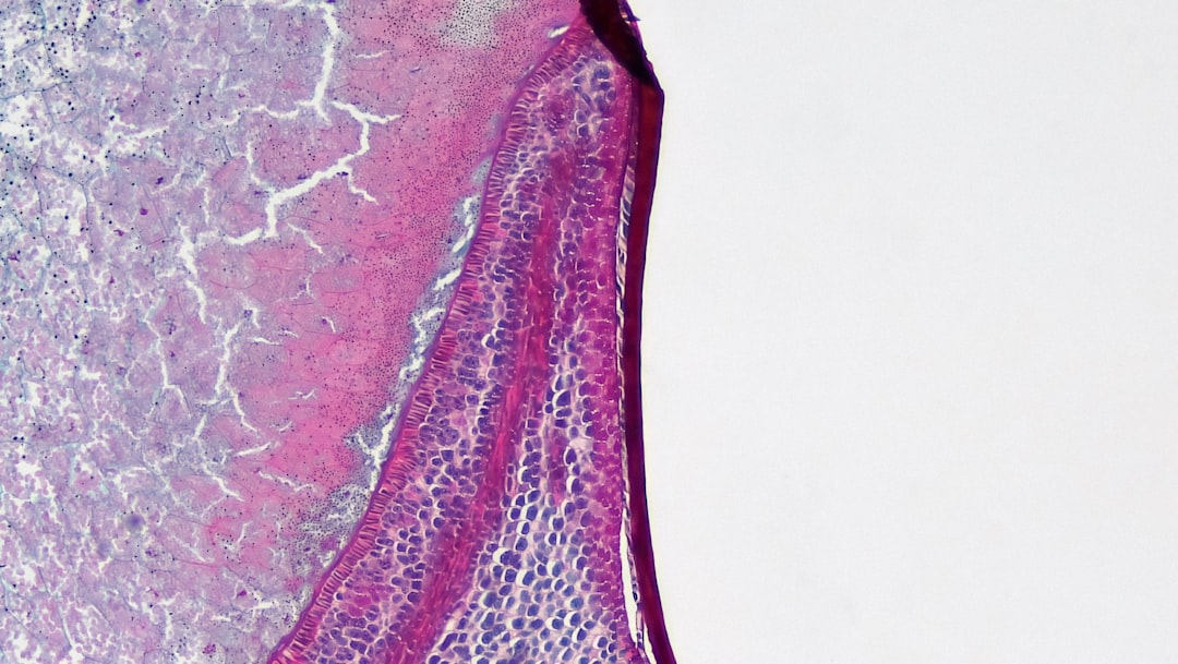 Photo lymph nodes