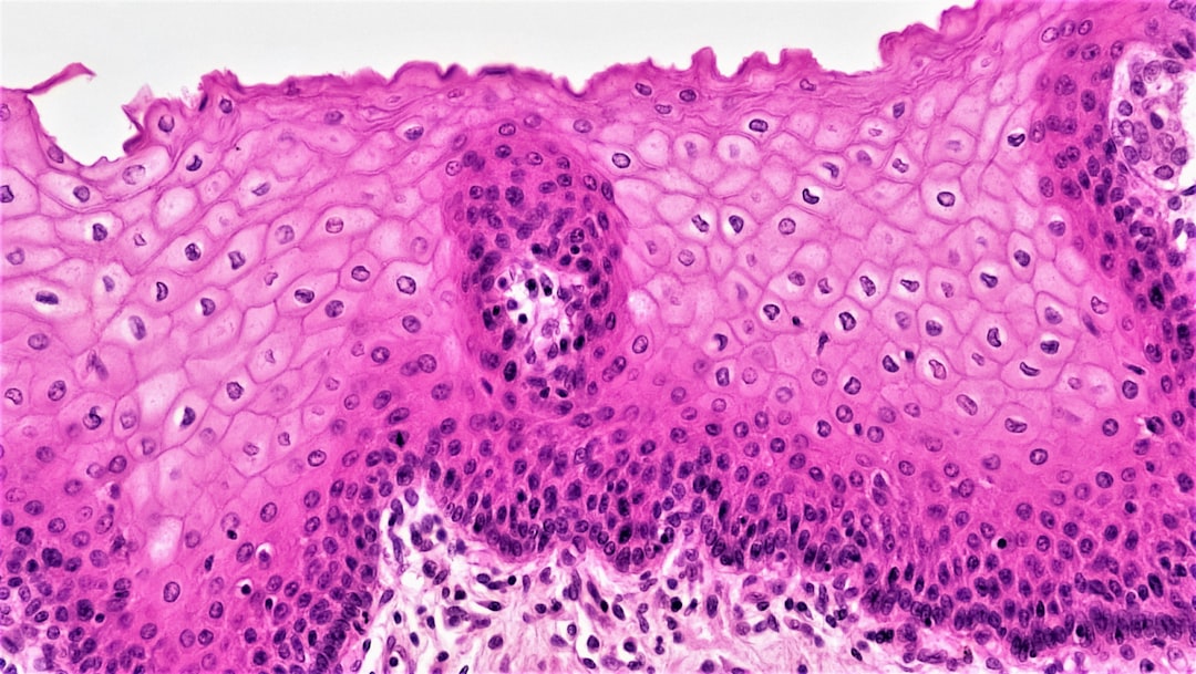 Photo lymph node enlargement