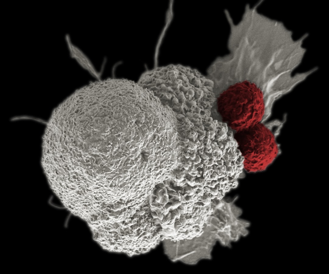 Photo TNM system cancer