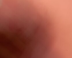 Photo Wegener granulomatosis epidemiology