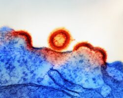 Photo Whipple disease research