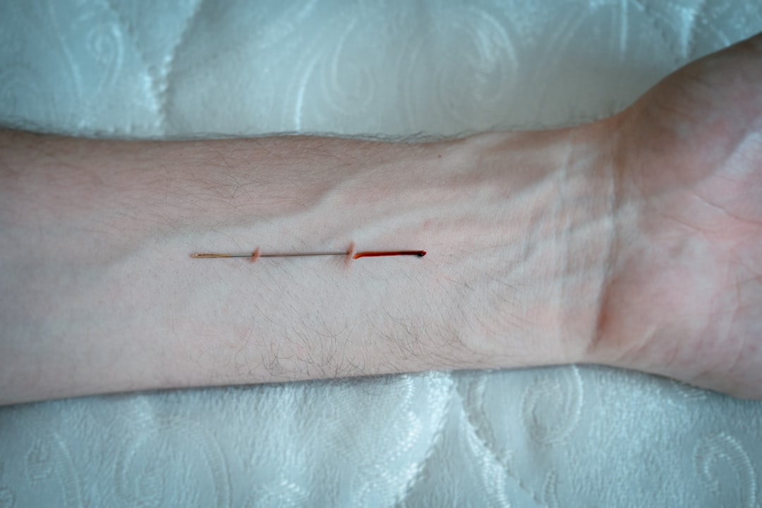 Photo flector pain relief