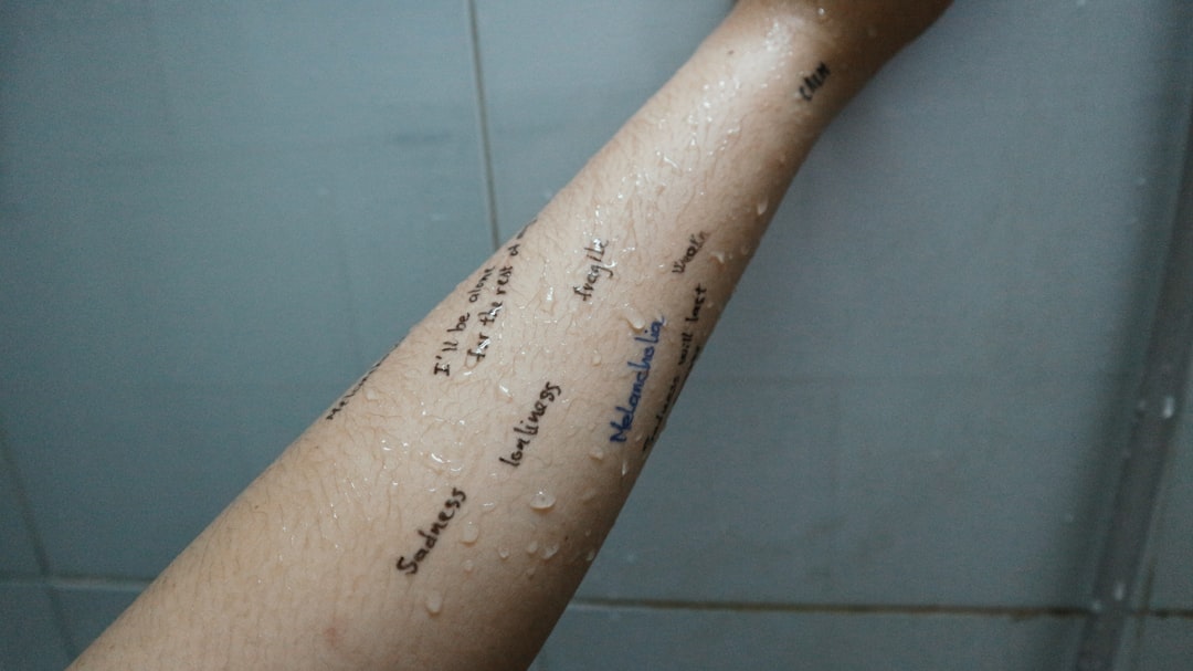 Photo Vitiligo treatment
