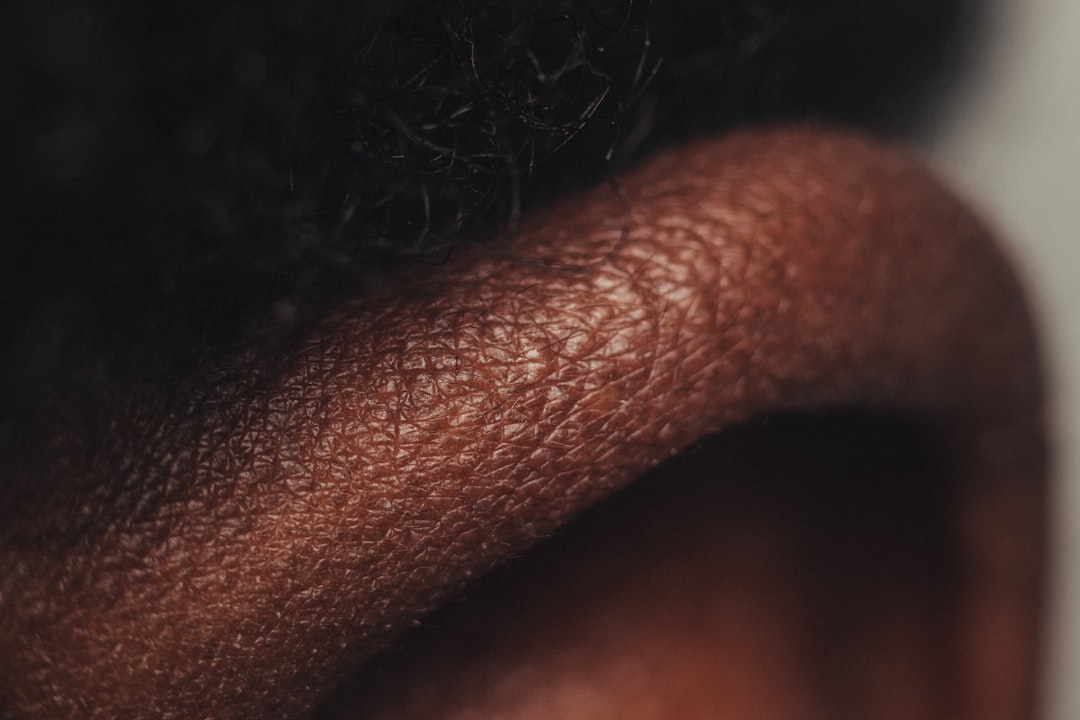 Photo Vitiligo diet