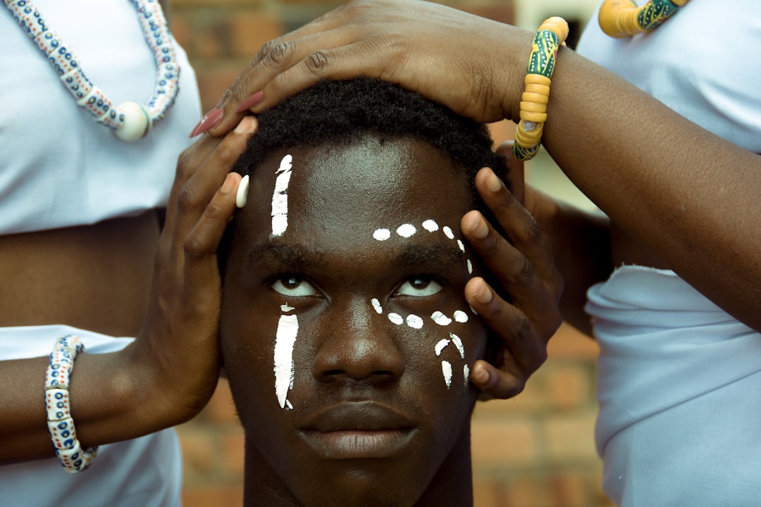 Photo Vitiligo treatment methods
