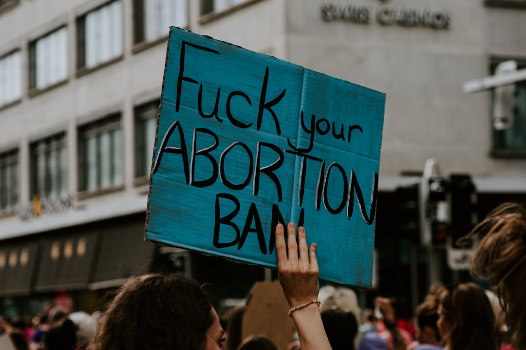 Photo 12 weeks fetus abortion
