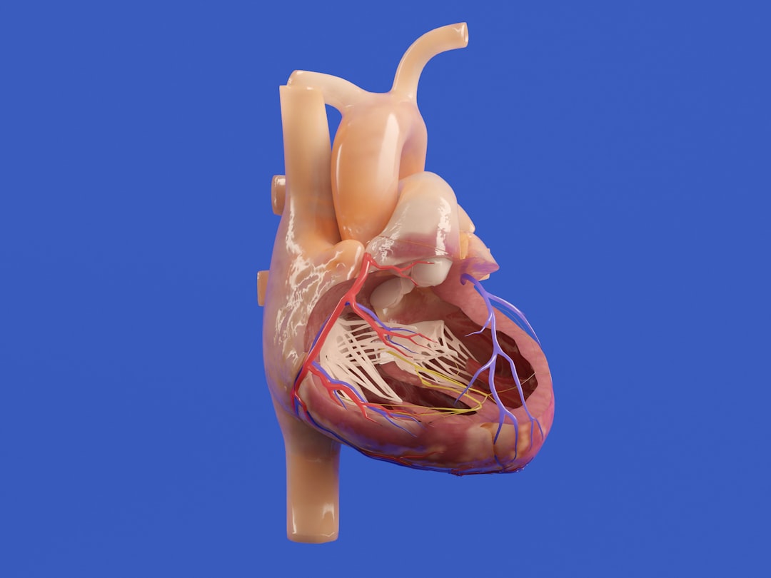 Photo fetal reduction