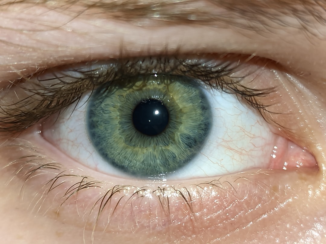 Photo xanthomas under eyes