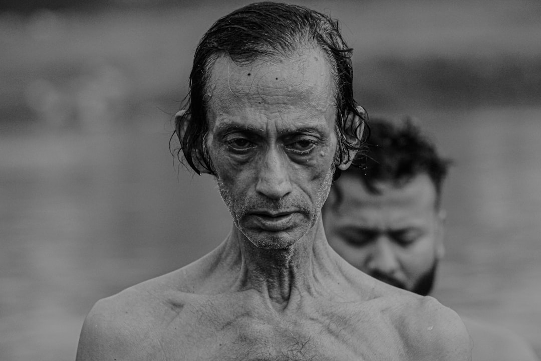 Photo Williams syndrome