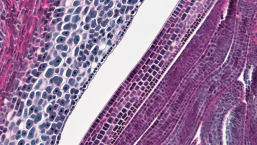 Photo verruciform xanthoma pathology