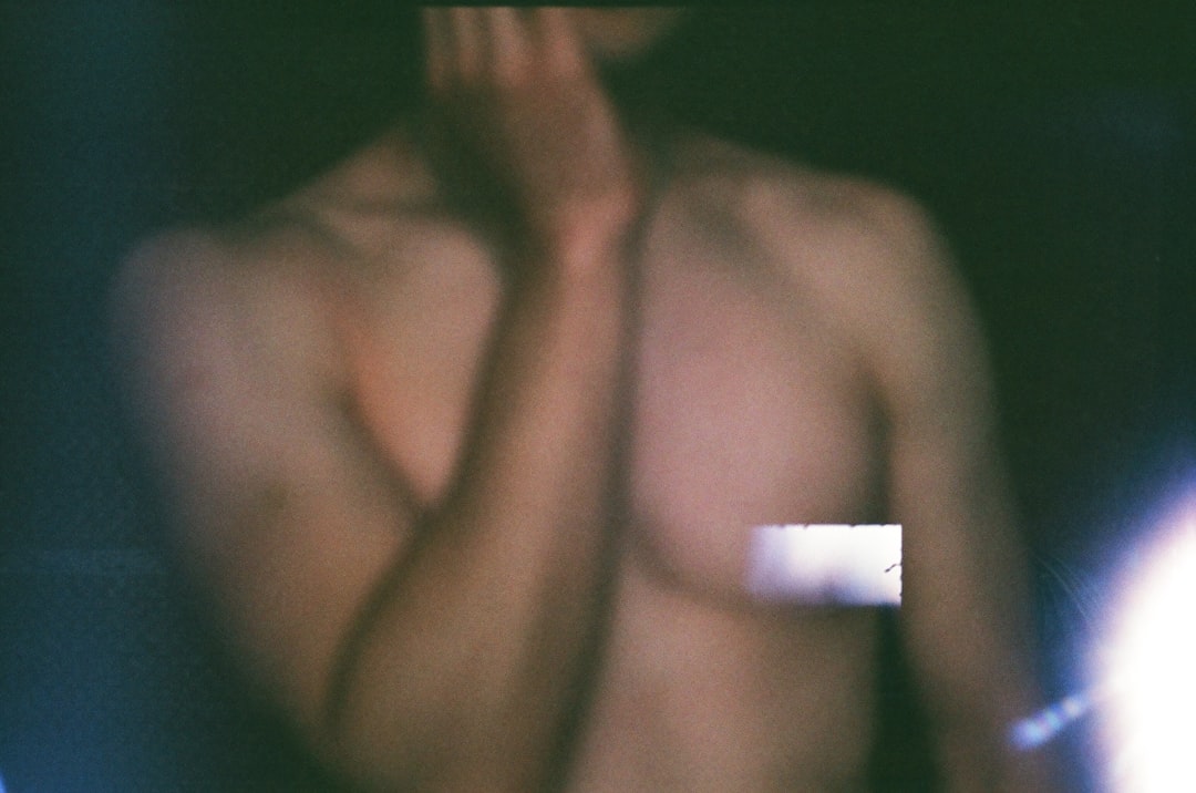 Photo williams beuren syndrome