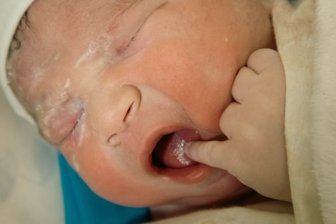 Photo reflux baby