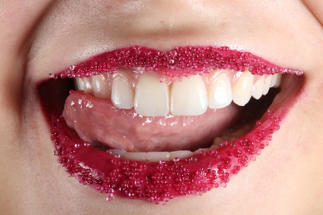 Photo reflux yellow tongue