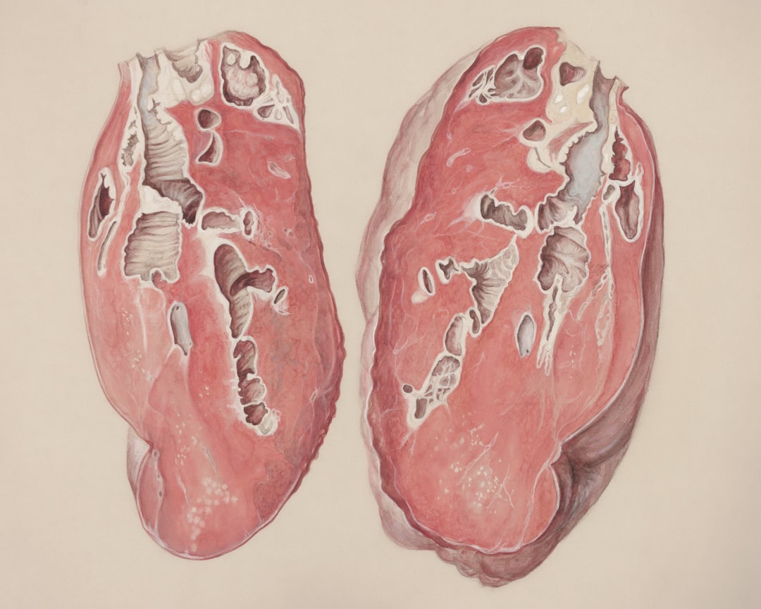 Photo reflux symptoms