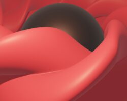 Photo reflux surgery