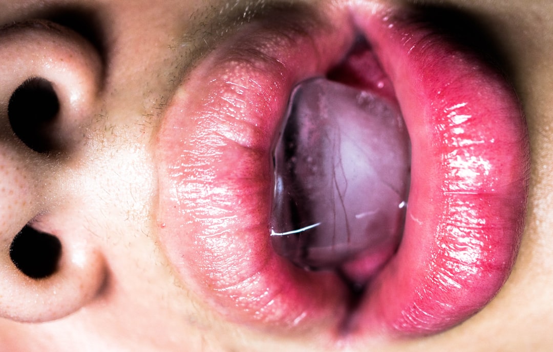 Photo inflamed esophagus