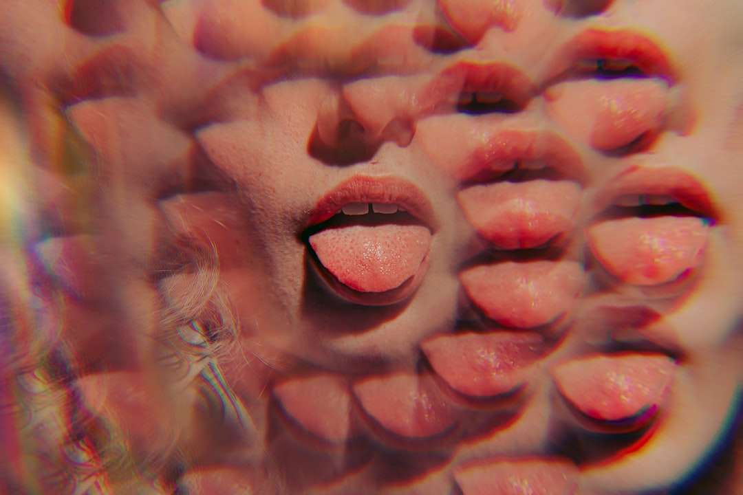 Photo acid reflux