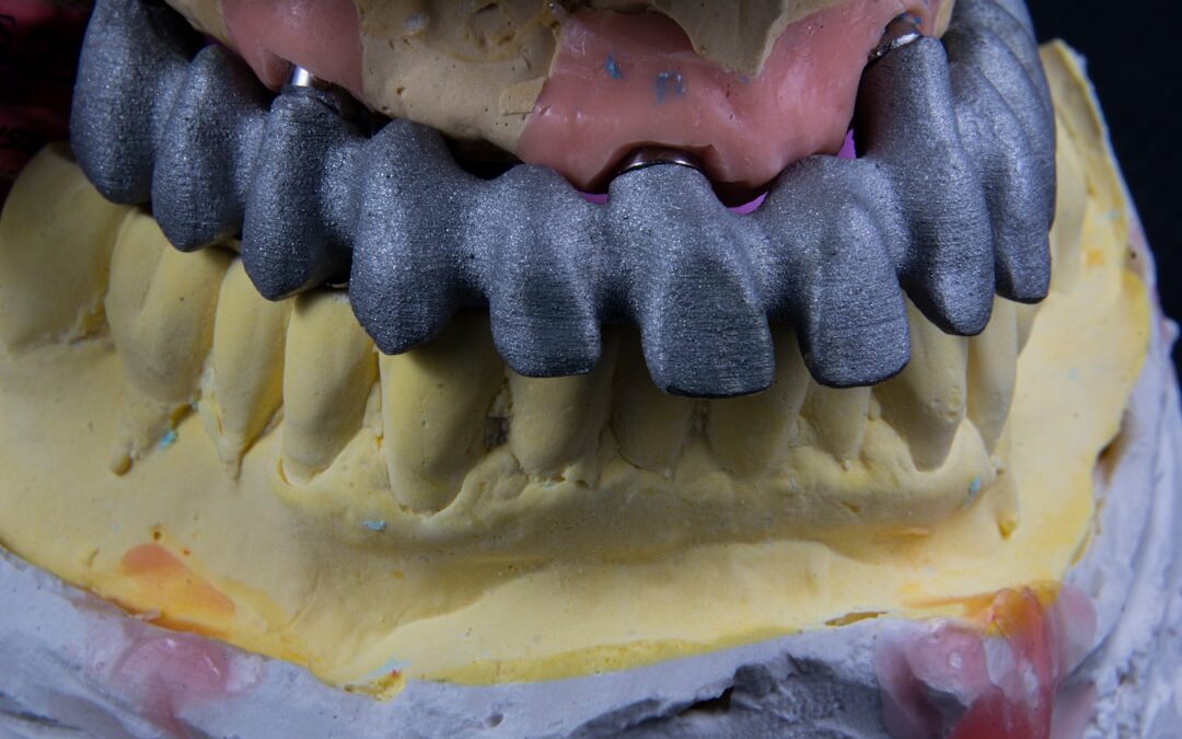 Photo full mouth reconstruction