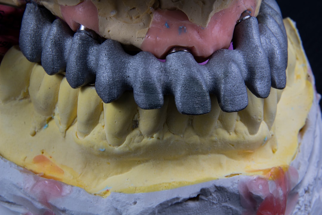 Photo full mouth reconstruction