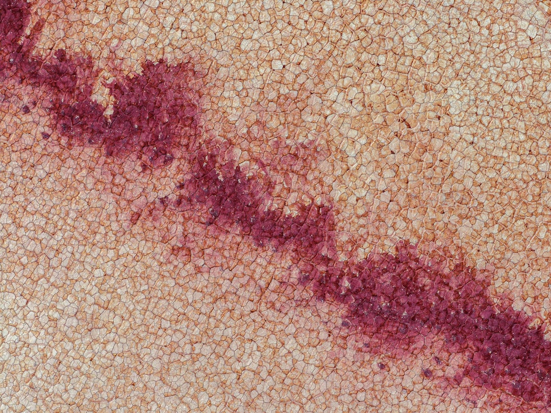 Photo homoktövis allergy