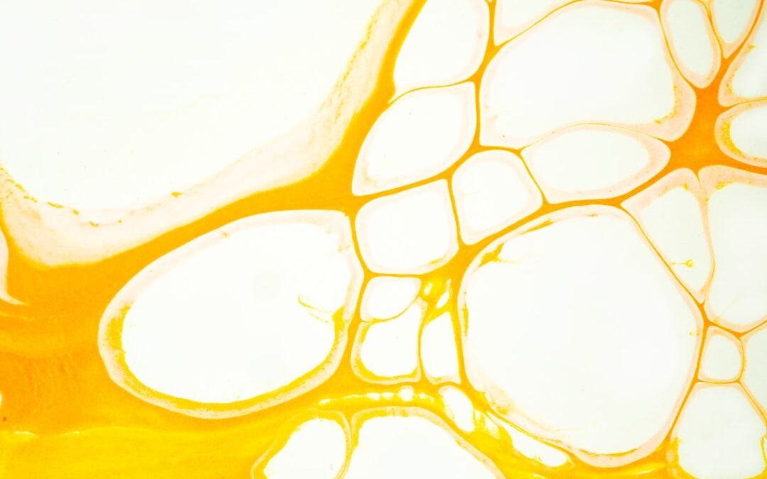 Photo homoktövis oil