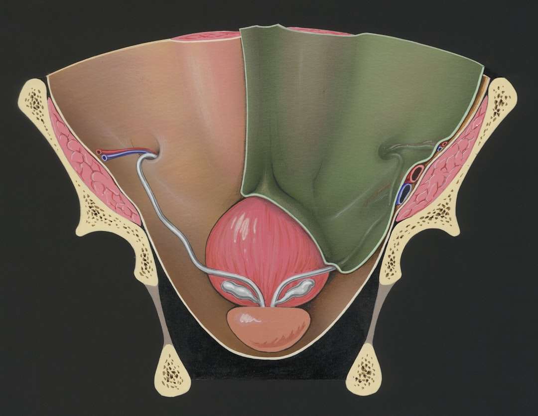 Photo Cesarean section