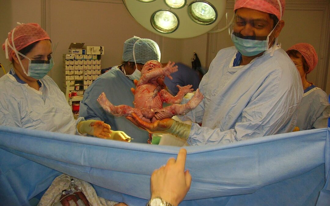 Photo Cesarean section