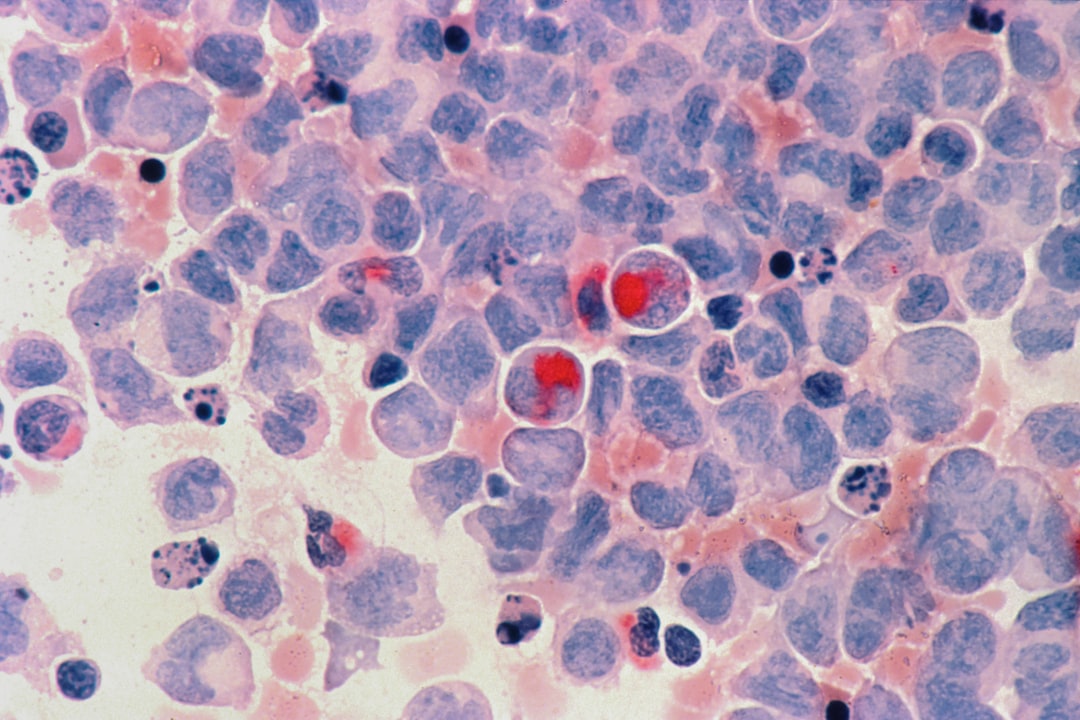 Photo Toxoplasma