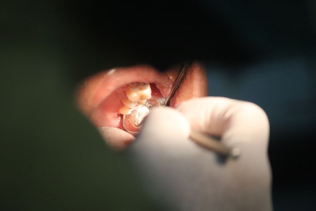 Photo wisdom tooth extraction