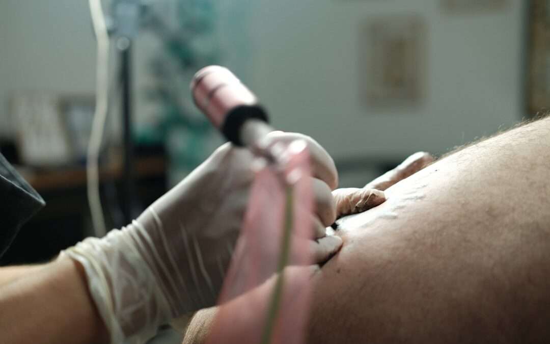 Photo Pregnancy and skin biopsy/dermatology: what fits in?