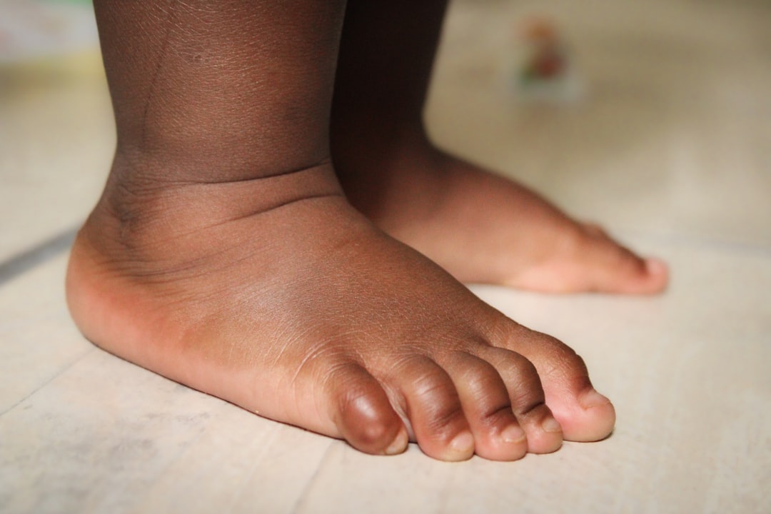 Photo childhood obesity treatment