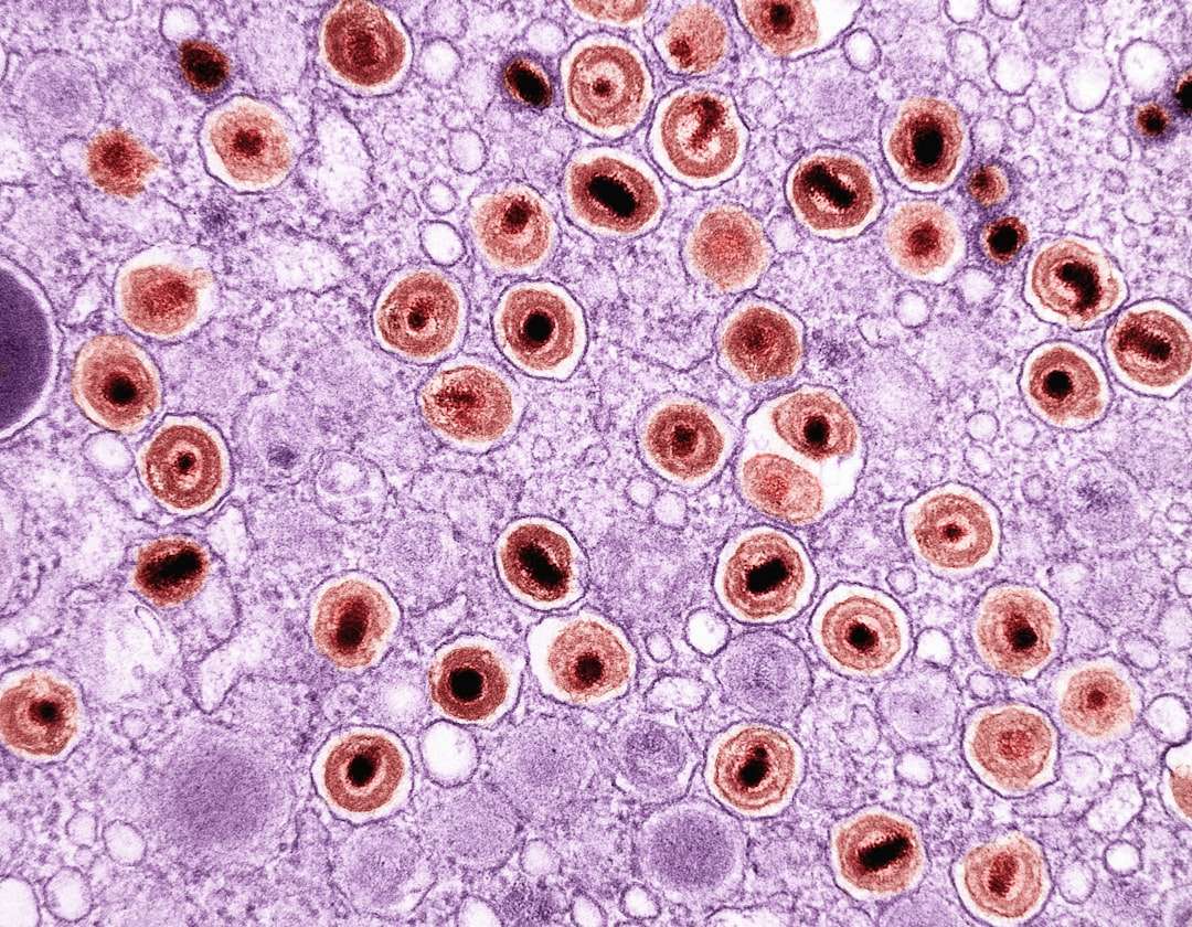 Photo fungal infection medication