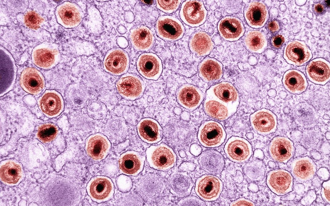 Photo bacterial infection