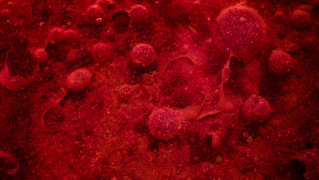 Photo lymphoma survival rates