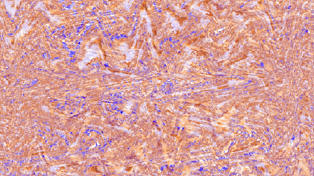 Photo lymphoma images