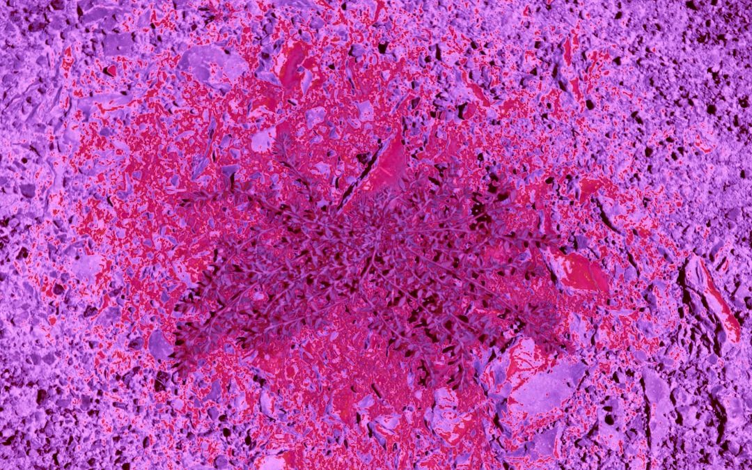 Photo lymphoma