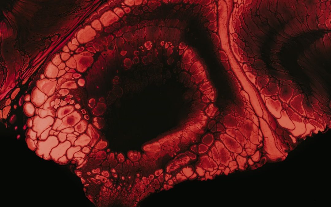 Photo lymphoma