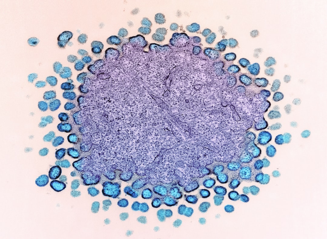 Photo lymphoma types