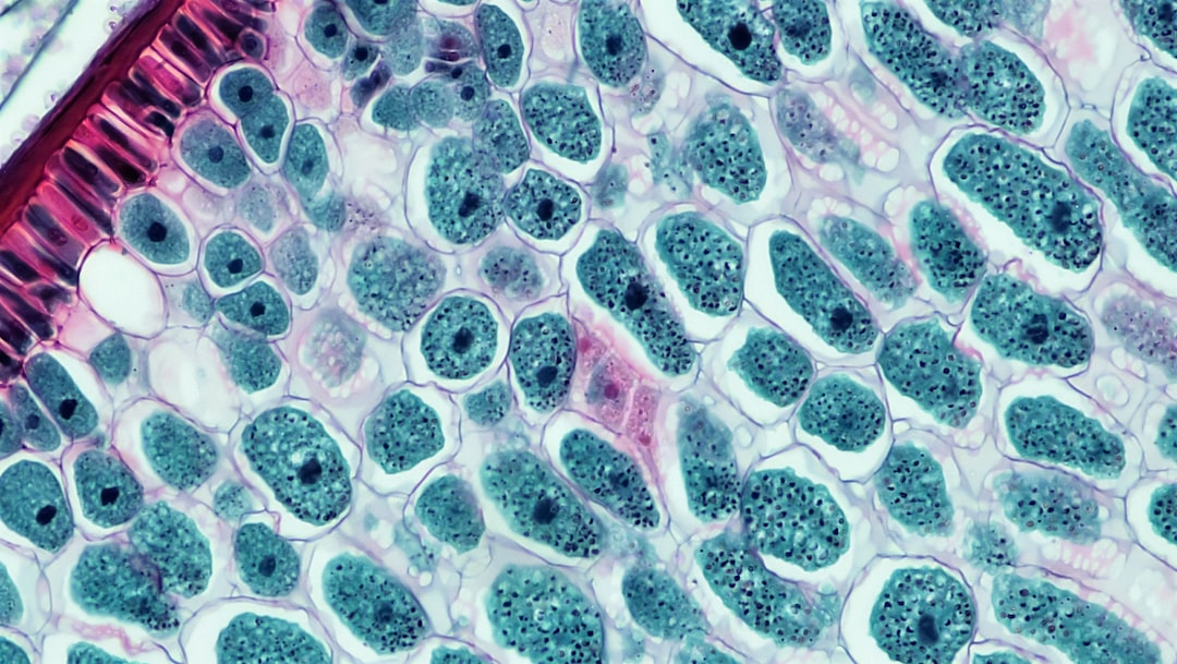 Photo diffuse large B-cell lymphoma