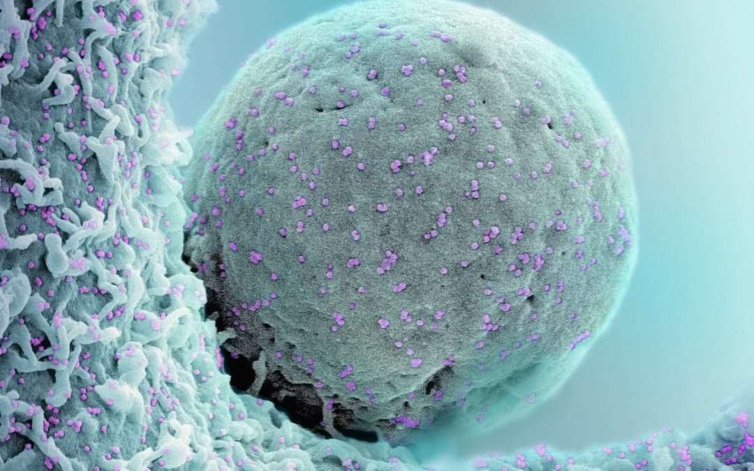 Photo stem cell transplantation lymphoma