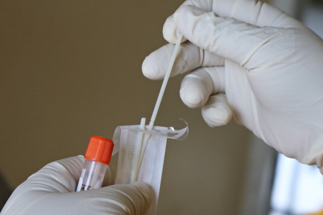 Photo lymphoma symptoms blood test