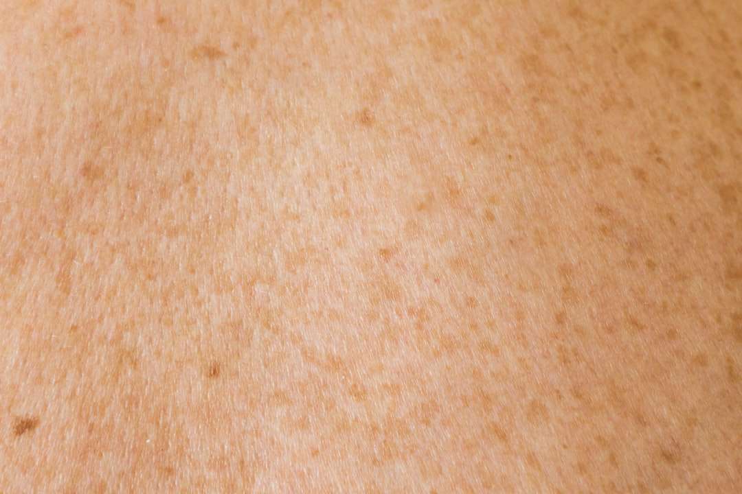 Photo skin diseases pictures