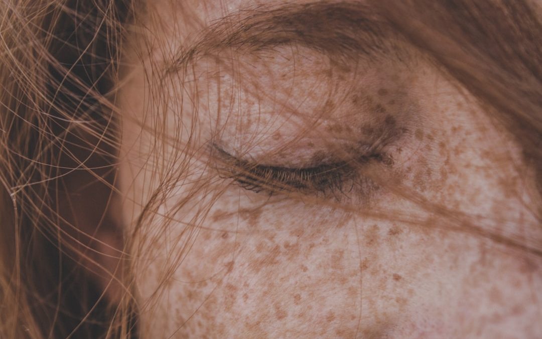 Photo skin diseases